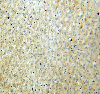 vitamin D binding protein Antibody