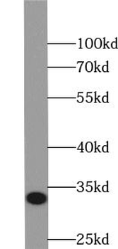 VNN2 Rabbit Polyclonal Antibody