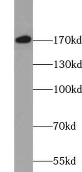 DCAF1 Rabbit Polyclonal Antibody