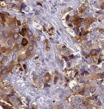 DCAF1 Rabbit Polyclonal Antibody