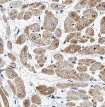 CHMP3 Rabbit Polyclonal Antibody