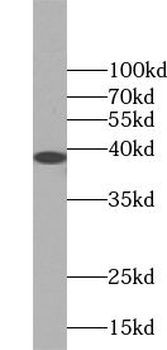 VPS26A Rabbit Polyclonal Antibody