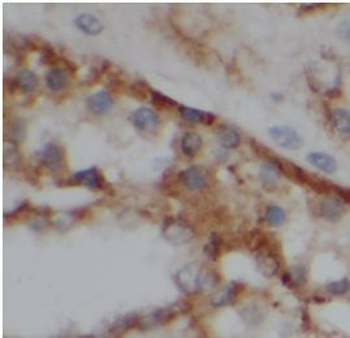 VPS26A Rabbit Polyclonal Antibody