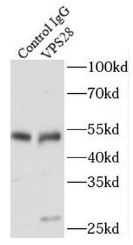VPS28 Rabbit Polyclonal Antibody
