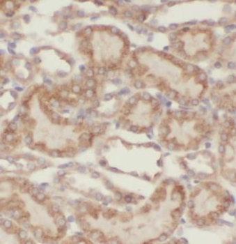 VPS33B Rabbit Polyclonal Antibody
