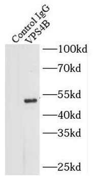VPS4B Rabbit Polyclonal Antibody