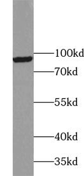 VPS53 Rabbit Polyclonal Antibody