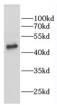 VRK2 Antibody