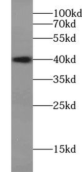 VSTM1 Rabbit Polyclonal Antibody