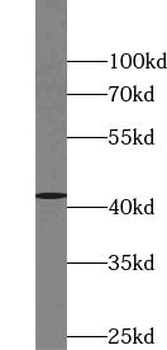 VSX2 Rabbit Polyclonal Antibody