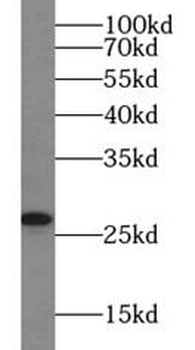 VTI1B Antibody