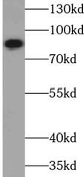 VWA2 Rabbit Polyclonal Antibody