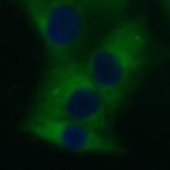 VWA2 Rabbit Polyclonal Antibody
