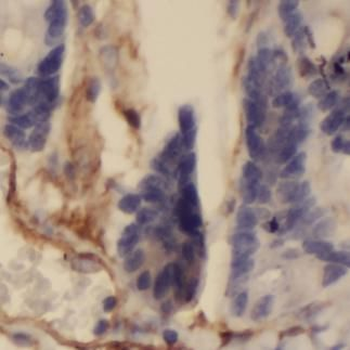 VWA2 Rabbit Polyclonal Antibody