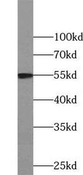 WASL Rabbit Polyclonal Antibody