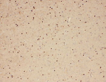 WASL Rabbit Polyclonal Antibody