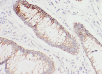 WBP1 Rabbit Polyclonal Antibody