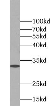 WBP2 Rabbit Polyclonal Antibody