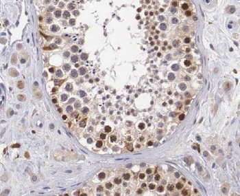 WBP2 Rabbit Polyclonal Antibody