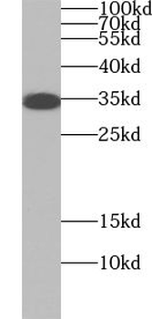 WBP2NL Rabbit Polyclonal Antibody