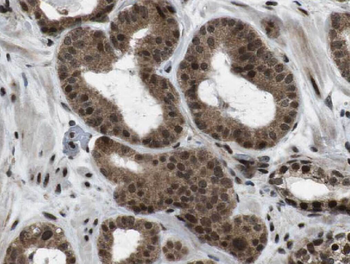 WBP2NL Rabbit Polyclonal Antibody
