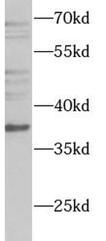 WDR5 Rabbit Polyclonal Antibody