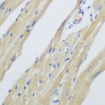 WDR77 Rabbit Polyclonal Antibody