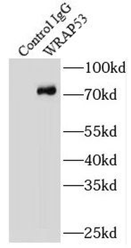 WRAP53 Rabbit Polyclonal Antibody