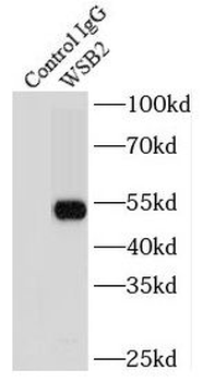WSB2 Rabbit Polyclonal Antibody
