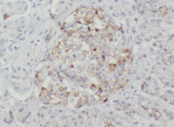 WSB2 Rabbit Polyclonal Antibody
