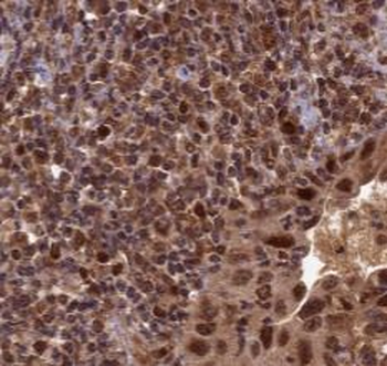 WTAP Mouse Monoclonal Antibody
