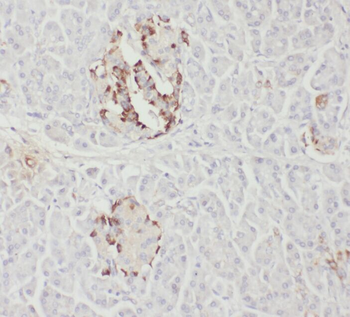 WWP2 Rabbit Polyclonal Antibody