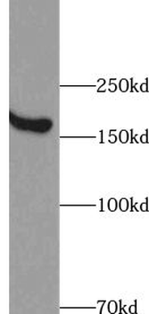 XRN1 Rabbit Polyclonal Antibody
