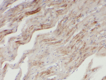 XRN1 Rabbit Polyclonal Antibody