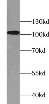 XRN2 Rabbit Polyclonal Antibody