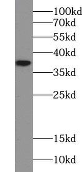 YOD1 Rabbit Polyclonal Antibody