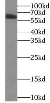 YTHDF1 Antibody