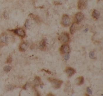 YTHDF1 Antibody