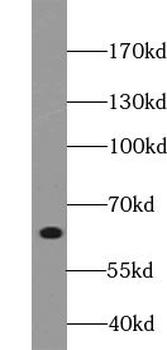 YTHDF2 Rabbit Polyclonal Antibody