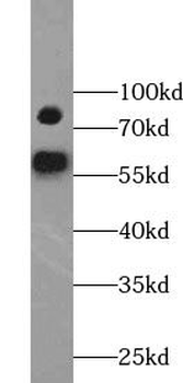 YY1AP1 Rabbit Polyclonal Antibody
