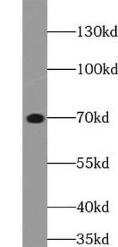 ZAP70 Rabbit Polyclonal Antibody