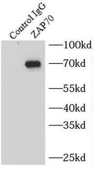 ZAP70 Rabbit Polyclonal Antibody