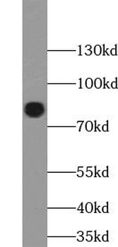 ZBTB48 Rabbit Polyclonal Antibody