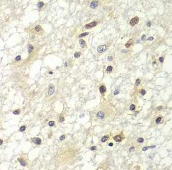 ZBTB48 Rabbit Polyclonal Antibody