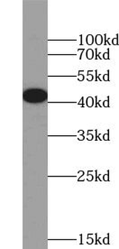 ZFP36 Rabbit Polyclonal Antibody