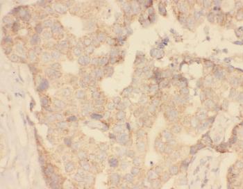 ZFP36 Rabbit Polyclonal Antibody