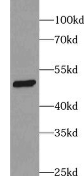 ZFP36L1 Rabbit Polyclonal Antibody