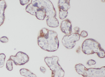ZFP36L1 Rabbit Polyclonal Antibody