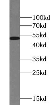 ZFP36L2 Rabbit Polyclonal Antibody
