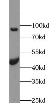 SLC39A8 Rabbit Polyclonal Antibody